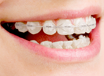 目黒区碑文谷・フェニックスこども矯正歯科